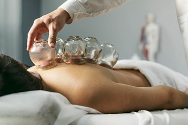 Cupping